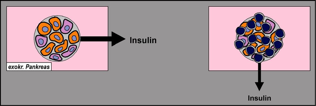 Typ I Diabetes mellitus (2): PG (1): - prinzipiell wird davon ausgegangen, dass es sich