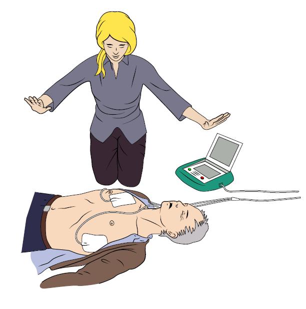 AED Bei Erwachsenen liegt in 25 50 % initial Kammerflimmern vor bei AED Aufzeichnungen bis zu 76% Defibrillation