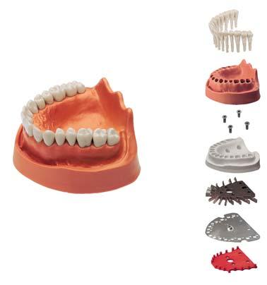 KaVo Studien- und Zahnmodelle Die idealen Arbeits-Bedingungen. Die Zahnfixierung Schneller ist einfach besser.