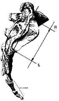 Material und Methoden Abbildung 49: Messpunkte der Länge der Facies auriculares Die Abbildung zeigt die laterale Ansicht des Kreuzbeins, an dem die Messpunkte für den
