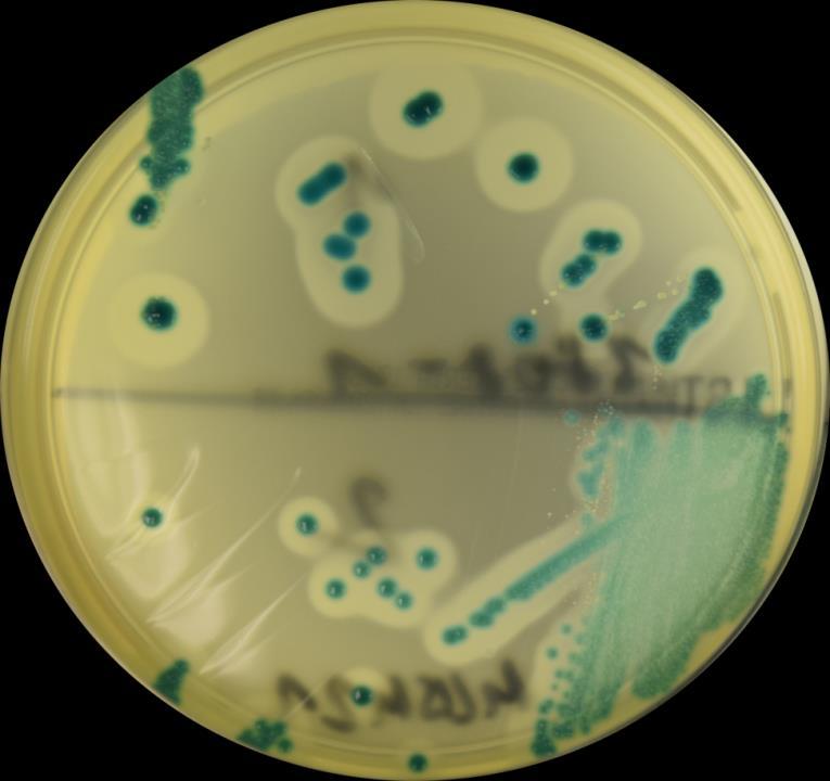 Listeria monocytogenes Differenzierung Listeria spp.