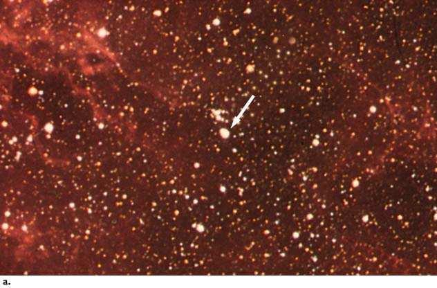 SN 1987A sn.