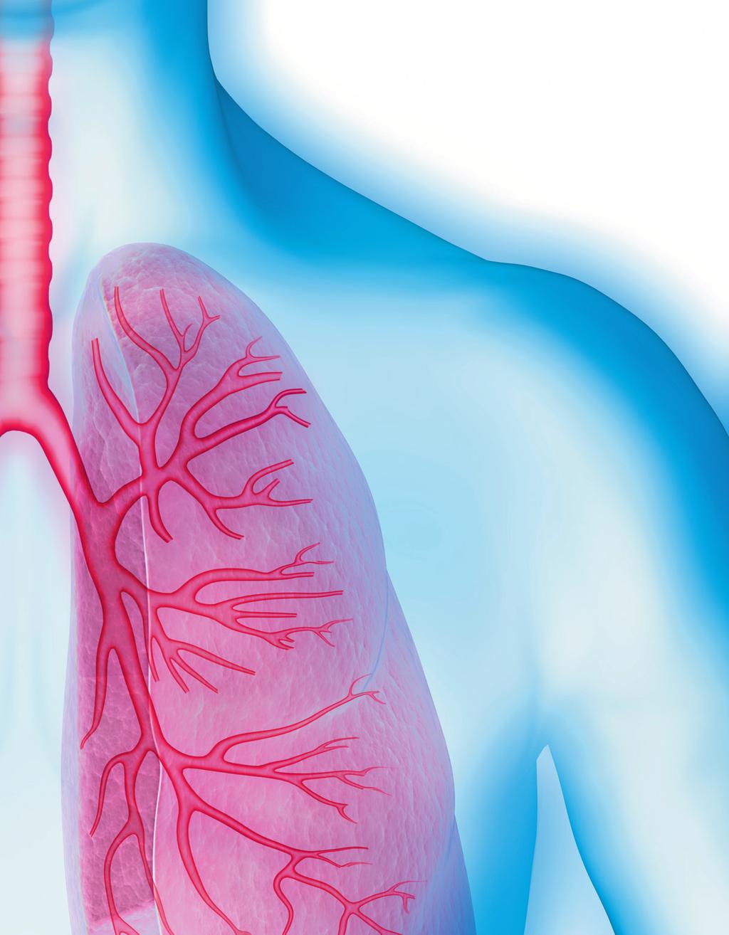 Inhalieren statt einnehmen Da die Erkrankung auf die Atemwege beschränkt ist, werden die meisten Medikamente eingeatmet oder inhaliert.