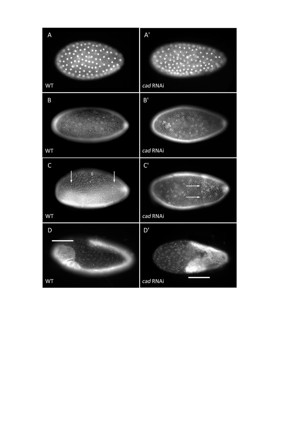 II. Kapitel: Mex-3/Cad System - Ergebnisse Abb. 16: Vergleich von Hoechst gefärbten WT und B.o. cad-rnai-embryonen Die anteriore Seite der Embryonen ist nach links orientiert.