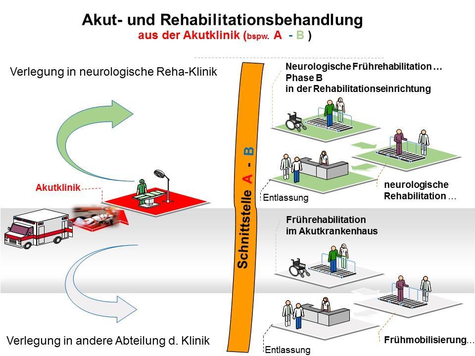 In Deutschland ist es eigentlich klar und unmissverständlich geregelt. Die Bundesarbeitsgemeinschaft für Rehabilitation (BAR) e.v. hat es in den 6 Phasen der neurologischen Akut- und Rehabilitationsbehandlung beschrieben.