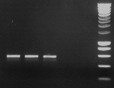 Ergebnisse 1500bp 1000bp 800bp 600bp 400bp 1 2 3 4 5 6 Abbildung 121 Auftrennung der amplifizierten Abschnitte (571 bp) für das Cycle-Sequencing der Regulator-Region des erma-gens im Transposon Tn554