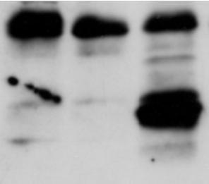 Ergebnisse 3.1.1 Nachweis der Expression von Bim S und FADD/DD in B16TREx-Zellen Abbildung 6 zeigt die Expression von Bim S und FADD/DD nach Induktion mit Tetracyclin (Tet) bzw.