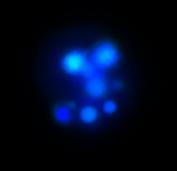 Ergebnisse A B C unbehandelt +Tet 6h +UV 6h Abb.9: Zellkernfragmentierung in Bim S -induzierten B16-Zellen.