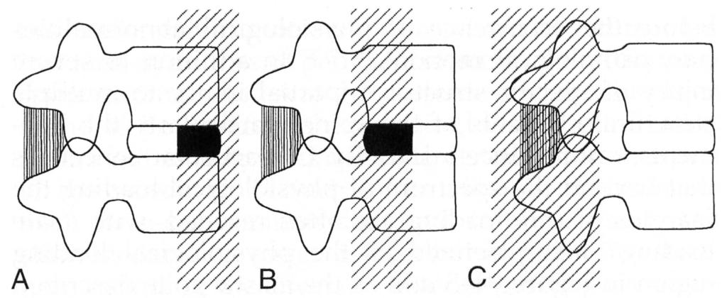 19 Abb. 3: 3-Säulen-Theorie nach Denis (1984).