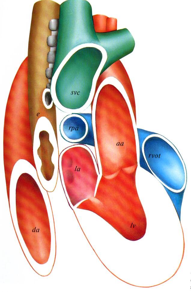 7. Mitt-ösophagealer Längsschnitt ( 90, 30 cm) Aortenklappe längs, ascendierende Aorta,
