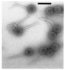 bekannt (46.375 bp, GenBank No. AF064539, Hendrix et al., 1998). N15 gehört zur Gruppe der Siphophagen, zu der auch λ und P4 zählen, und benutzt E. coli als Wirt (Svarchevsky & Rybchin, 1984).