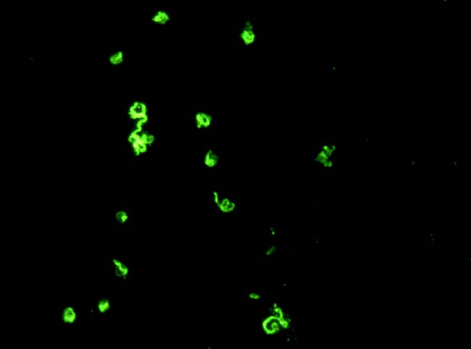 Borrelia