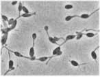 Purpurbakterium mit intrazellulären