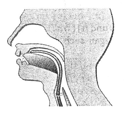 unterschiedlichen Artikulationsorten Verschlu sse vorgenommen werden: mit den Lippen ([m]) bzw. mit der Zunge und vorderem ([n]) bzw. hinterem Gaumen ([8].