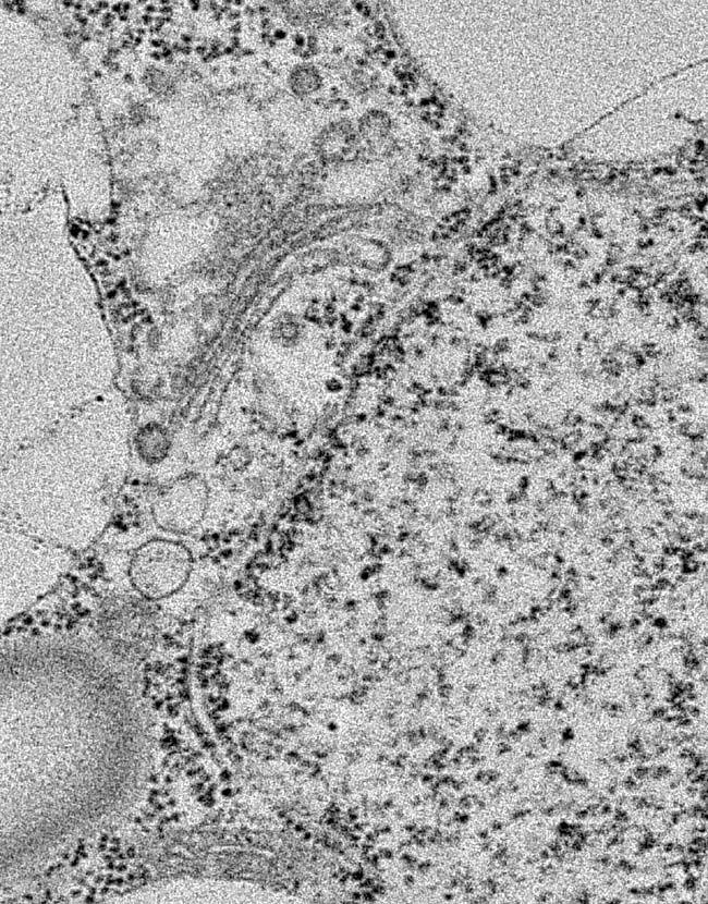 11 Der Golgi Apparat (Dictyosom) Der Golgi-Apparat ist ein Membransystem, welches aus 4-12 Schichten von übereinander liegenden Membranen besteht, welche in den Randbereichen Vesikel abschnüren.