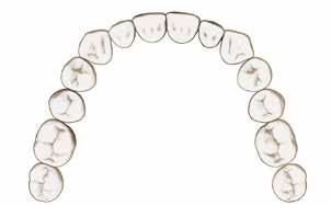 Einführung Implantatgröße/Zahnposition Interface-Verbindung von Implantat und Abutment Die Designphilosophie des ASTRA TECH Implant System EV basiert auf den natürlichen Zähnen und einem