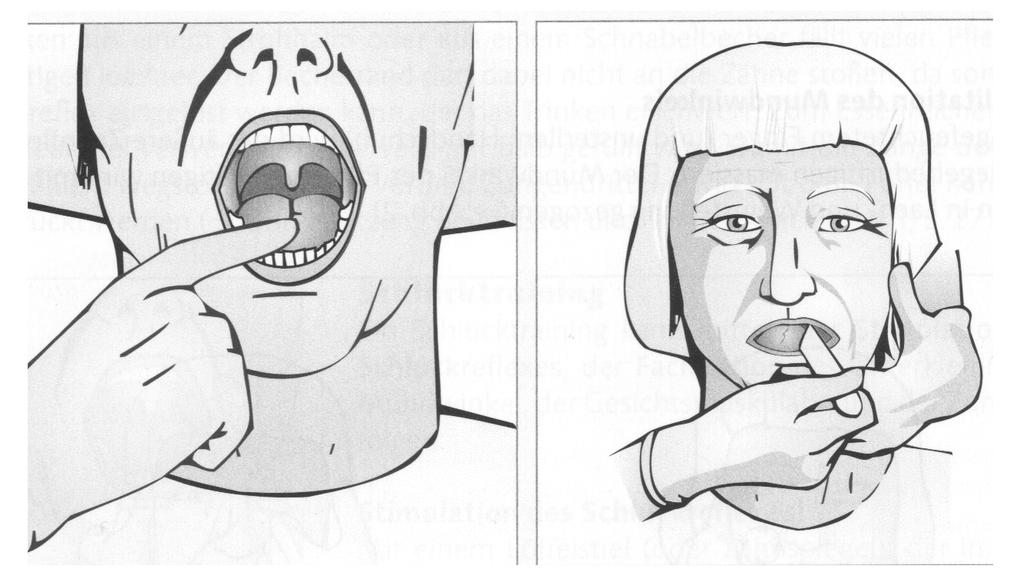 Facilitation der Zunge (schult das Lage- und Beweglichkeitsbefinden der Zunge und unterstützt das Sprechen) Mit feuchtem Finger leicht auf die Zunge drücken Die Zunge von der