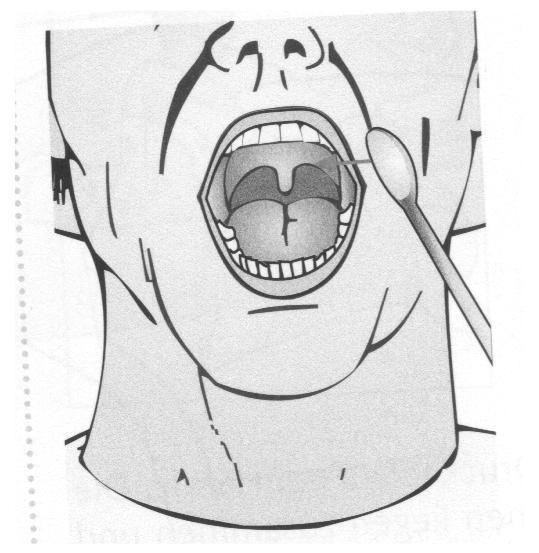 Schlucktraining Ein Schlucktraining kann mittels der Stimulation des Schluckreflexes, der Facilitation des Unterkiefers, der Mundwinkel, der Gesichtsmuskulatur und der Zunge erfolgen.