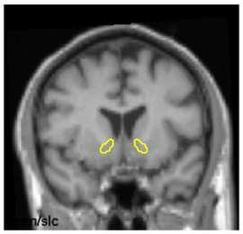 striatum occipital cortex 0-60 min. p.i. 1 1 ventral striatum