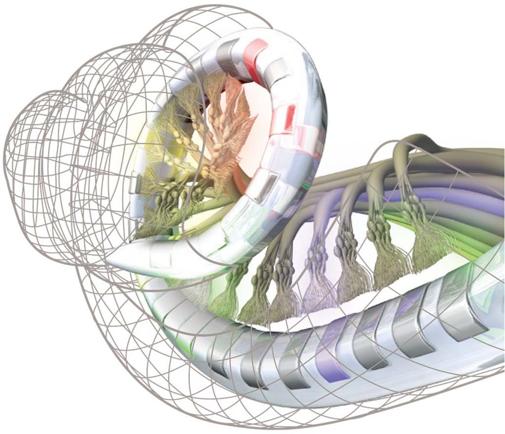 Perimodiolare Elektrodenlage an die natürliche Form der Cochlea angepasst Positionierung in unmittelbarer Nähe der Spiralganglinienzellen Konsistente Platzierung der Elektrode für erstklassige
