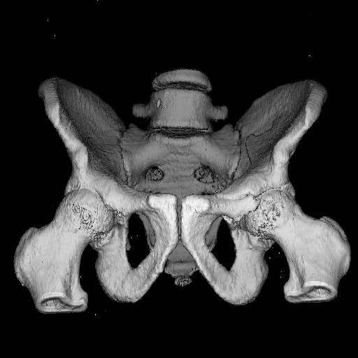 Bildgebende nicht-invasive in vivo-verfahren Röntgen (klassisch, CT) Sonographie