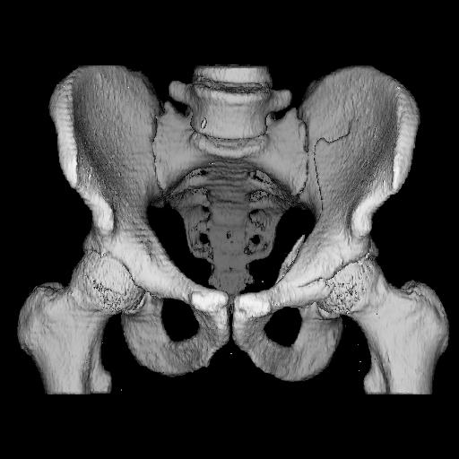 Bildgebende nicht-invasive in vivo-verfahren Röntgen (klassisch, CT) Sonographie