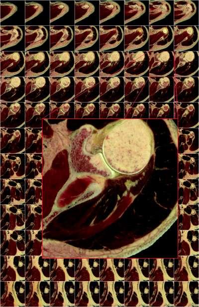 Bildgebende nicht-invasive in vivo-verfahren Röntgen (klassisch, CT) Sonographie