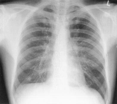 Bildgebende nicht-invasive in vivo-verfahren Röntgen (klassisch, CT) Sonographie