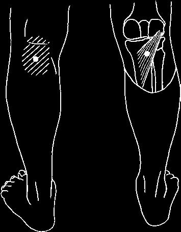40, S. 307) Halbsehnenmuskel (M. semitendinosus) und Plattsehnenmuskel (M.