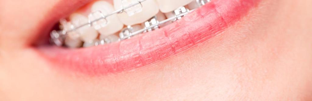 Wenn Sie das Gefühl haben, dass der Zusammenbiss Ihrer Zähnen nicht stimmt, oder wenn Sie Verspannungen und Schmerzen im Bewegungsapparat haben, sollten Sie sich zahnärztlich untersuchen lassen.