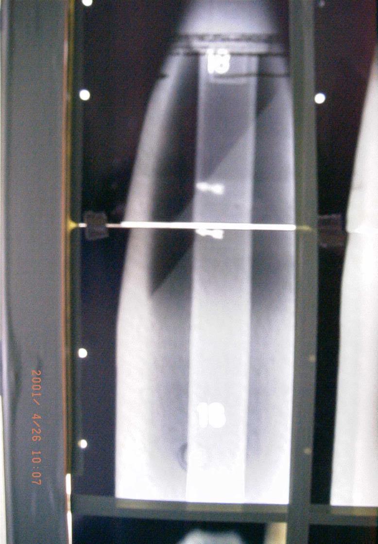 Röntgenbilder von