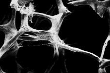 Knochenmasse (Substanz) Knochenstruktur und