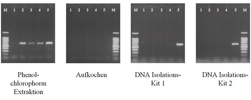 ZIEL - Abteilung Mikrobiologie 93 bensmitteln und ein auf DNA Fällung basierender Isolation Kit für grampositive Bakterien.