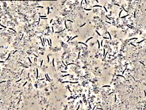 88 ZIEL - Abteilung Mikrobiologie zelt wurden rundovale Sporen in endständigen, geschwollenen Sporangien gesehen. Über ein Sterilfilter wurde weiter aufkonzentriert und Peptide und Salze entfernt.