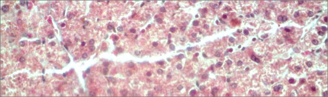 Zwei Reihen benachbarter Hepatocyten umschliessen mit ihren Zellwänden innerhalb ihrer Bälkchen die feinsten Gallenkanälchen, die Canaliculi biliferi, die am Rande des Lobulus in ein Hering Kanälchen