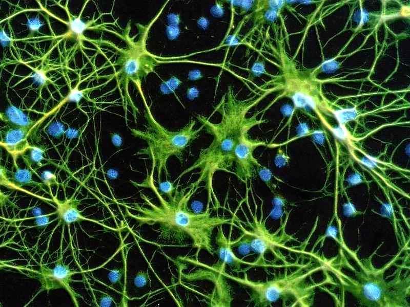 Feste Wissensbestände bilden starke neuronale Netzwerke; eine neue sehr sehr leichter