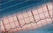 Diagnosetechniken (1) Röntgenaufnahme Herzgröße und Herzform Flüssigkeitseinlagerungen in der Lunge Elektrokardiogramms (EKG) Herzrhythmus-Störungen Schäden im Bereich der Herzkranzgefäße