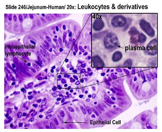 Intraepitheliale Lymphozyten (IEL) sind CD8+ γδ-t-zellen mit einer dendritischen Morphologie sind zytotoxische Effektorzellen IEL: intraepitheliale Lymphozyten SEL: subepitheliale Lymphozyten