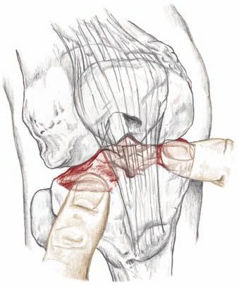 Lokalisieren Sie die Tuberositas tibiae. 2. Gleiten Sie mit den Fingern etwa sieben bis zehn Zentimeter zur Außenseite des Beins. Palpieren Sie das Caput fibulae (7.19).