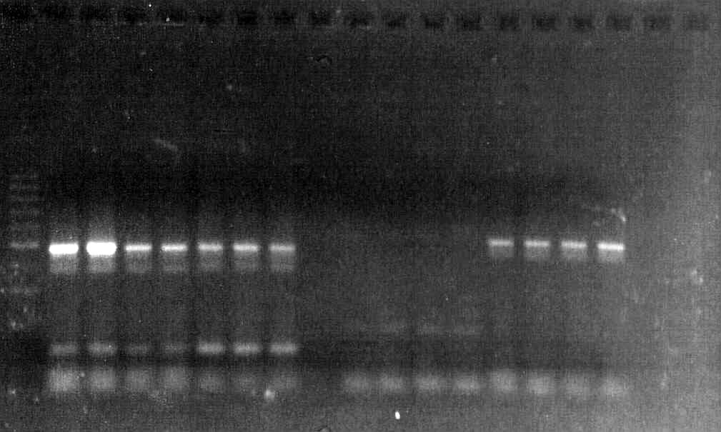konstruiert. Die PCR erfolgte bei 58 C und variierter MgCl 2 -Konzentration von 1,5mM bis 2,5mM. Es wurden 10µl des Standards und der PCR-Produkte aufgetragen.