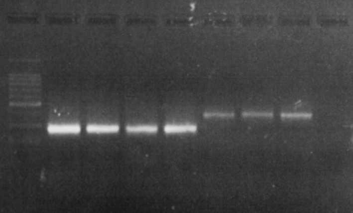 100bp Bt Oa Ss Ec Gg Str Mg NTC Abb. 5-6.: Agarosegel der PCR zur Amplifikation des Intron/Exon- Übergangs 10µl des.