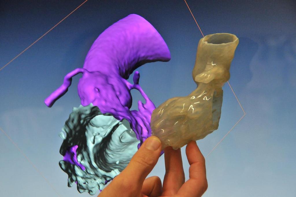 Ausblick und Zukunft: vom 3D Bild zur 3D Form Quelle: PD Dr. C.
