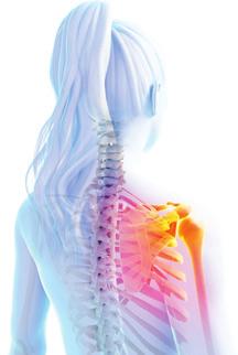 Rotatorenmanschettenriss Die mit Abstand häufigste Ursache für chronische Schulterschmerzen sind Probleme mit der sogenannten Rotatorenmanschette.