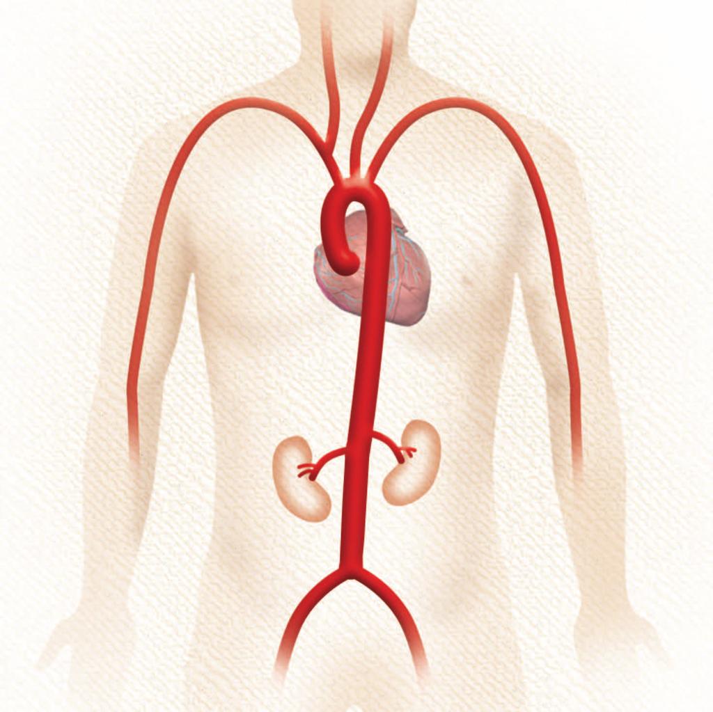 Die Bauchaorta beginnt unterhalb der Nierenarterien und erstreckt sich bis zu dem Punkt, an dem sich die Aorta in die