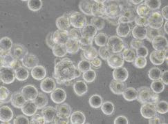 In vitro: Problemfall Soja Soja reagiert auf Nierenzellen wie reine Östrogene Pflanzenöstrogenaktivität im Mischfutter (µg/kg us) 600 500 400
