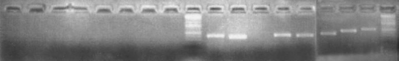 48 CHD1L-20R tcagcctccagaactataagg 14 Ergebnisse, 3 auf Chromosom 1 CHD1L-21F tgctgttcaggcatagcatcc Nur eine Sequenz, eindeutig für CHD1L, Ex 21 CHD1L-21R ggctatatgactacaagacgg Nur eine Sequenz,