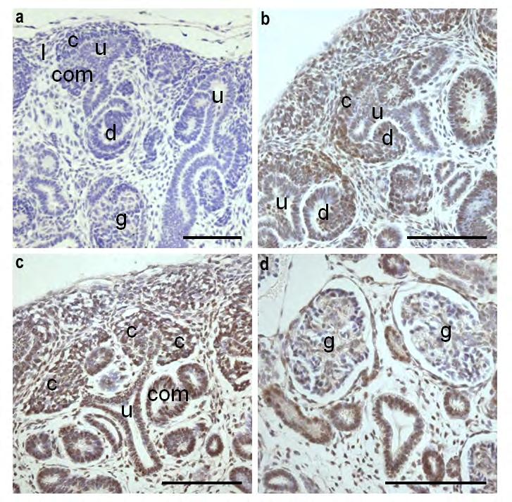 71 Abb. 19 Immunhistochemische Untersuchung der Lokalisation der CHD1L-Expression während der Nierenentwicklung von der siebten bis zur elften Woche an humanen embryonalen Nierenschnitten.