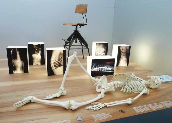 28 Im Blick BG BAU aktuell 3_2012 Die Ausstellung zeigt, wie sich Ernährung und dauerhaftes Sitzen auf das Knochengerüst auswirken.