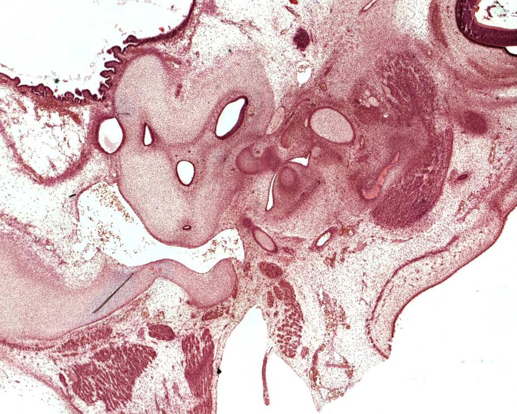 4.3.3 Processus styloideus und Ligamentum stylohyoideum Auch bei diesem Embryo ist die Zusammensetzung des Processus styloideus aus zwei Bestandteilen deutlich im histologischen Schnitt zu sehen (Abb.