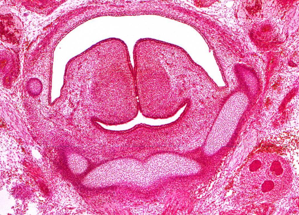 Cartilago thyroidea, cornu superius Cornu maius ossis hyoidei, sinistrum N. hypoglossus Cornu maius ossis hyoidei, dextrum Corpus ossis hyoidei Gl. submandibularis 500 µm Abb. 25 Embryo 25 mm SSL, 7.